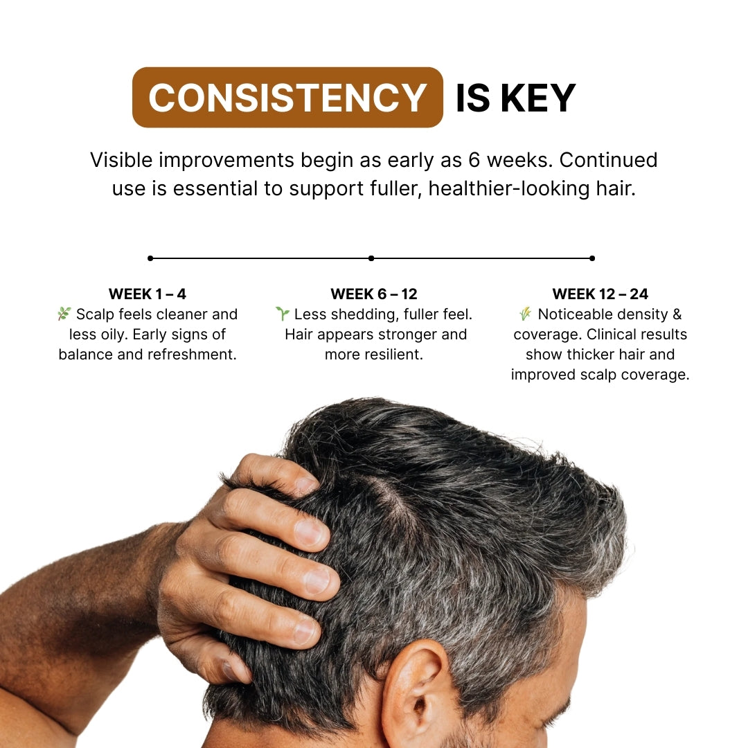 KX-826 Plant Extract Hair Regrowth Treatment